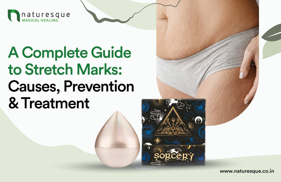A Complete Guide to Stretch Marks: Causes, Prevention & Treatment