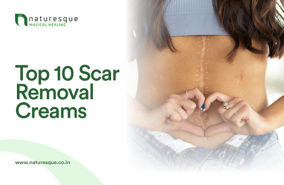 Top 10 Scar Removal Creams