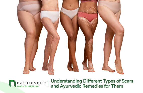 Understanding Different Types of Scars and Ayurvedic Remedies for Them
