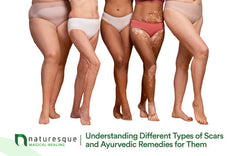 Understanding Different Types of Scars and Ayurvedic Remedies for Them