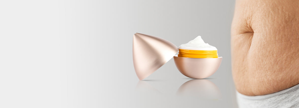 Sorcery: Stretch Marks Cream for Pregnancy & After Delivery – Naturesque