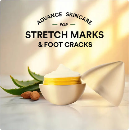 Sorcery - Stretch Marks Removal Cream for Pregnancy, Fade, Reduce Stretch Marks, Foot Crack Cream