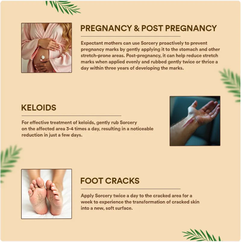 Sorcery - Stretch Marks Removal Cream for Pregnancy, Fade, Reduce Stretch Marks, Foot Crack Cream